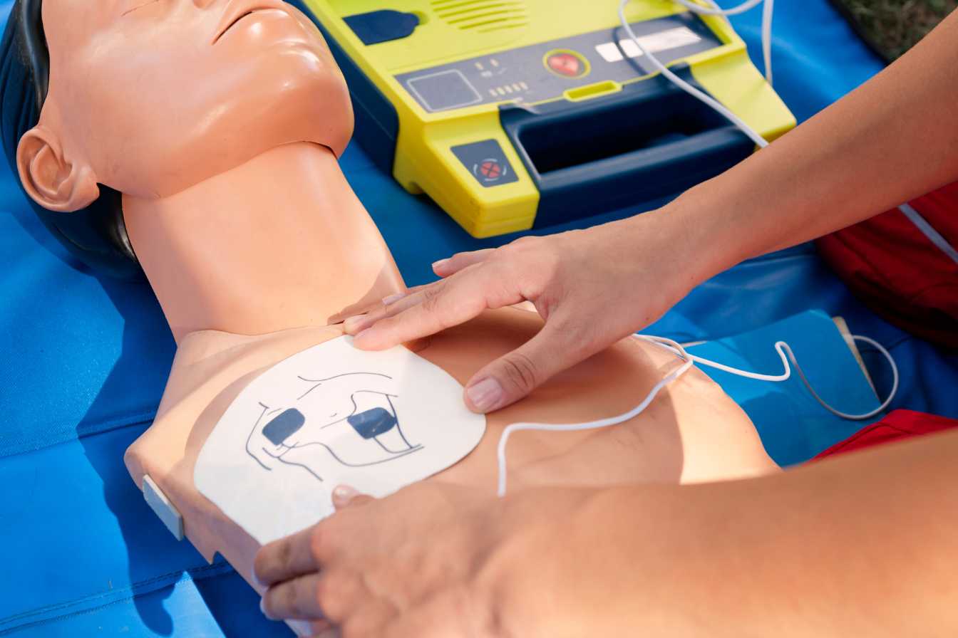electrodes defibrillateur 1